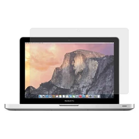 Xprotector XPRO™ Ultra Clear kijelzővédő fólia Apple MacBook Pro 13.3" (2016-2020) / Air 13.3" (2018-2019) készülékhez
